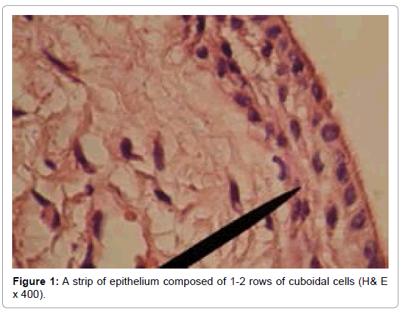 oral-hygiene-health-a-strip-epithelium-composed