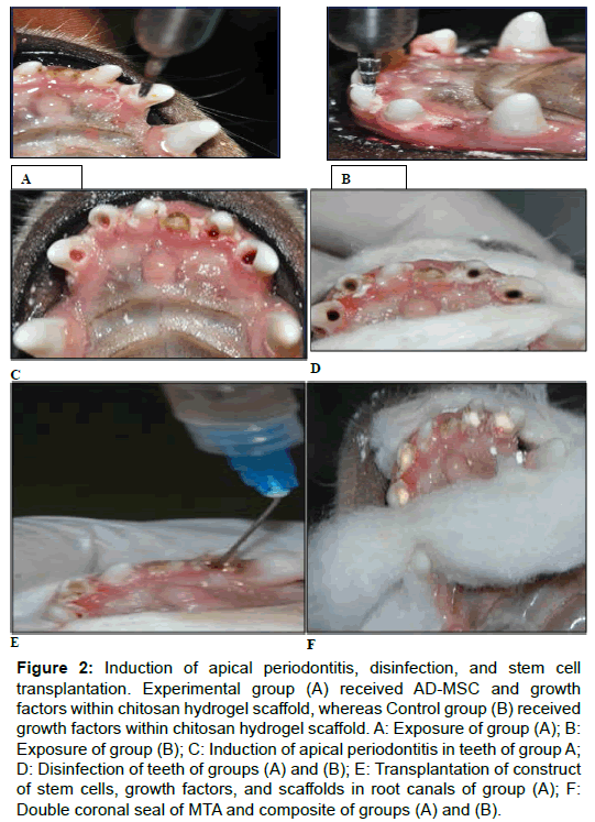oral-hygiene-health-apical-periodontitis-disinfection