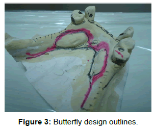 oral-hygiene-health-butterfly-design-outlines