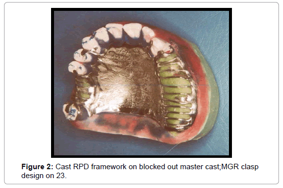 oral-hygiene-health-cast-rpd-framework