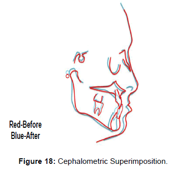 oral-hygiene-health-cephalometric-superimposition