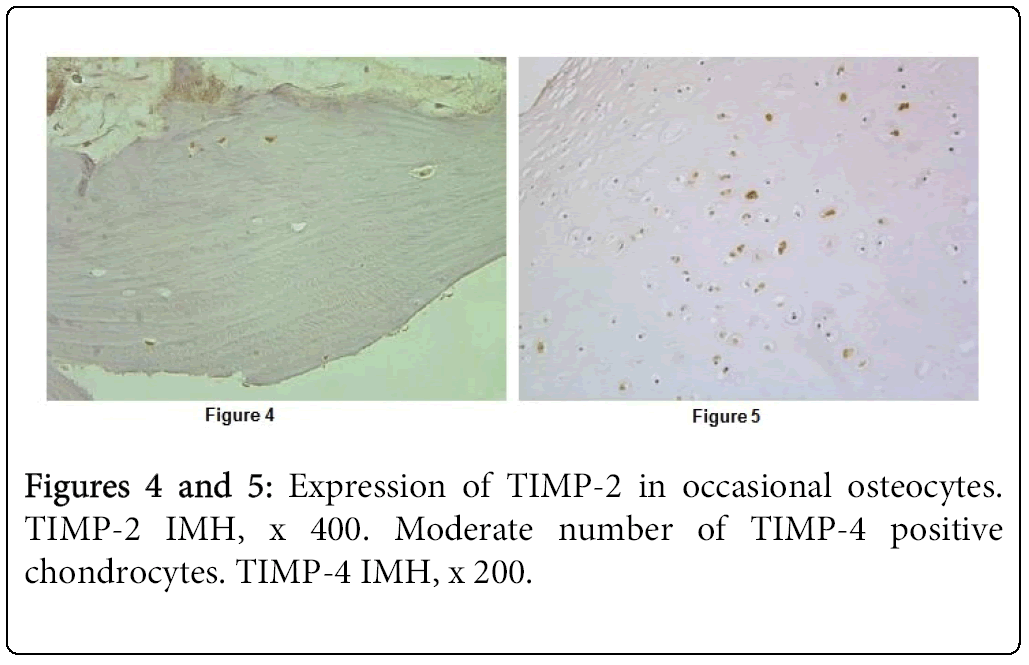oral-hygiene-health-chondrocytes