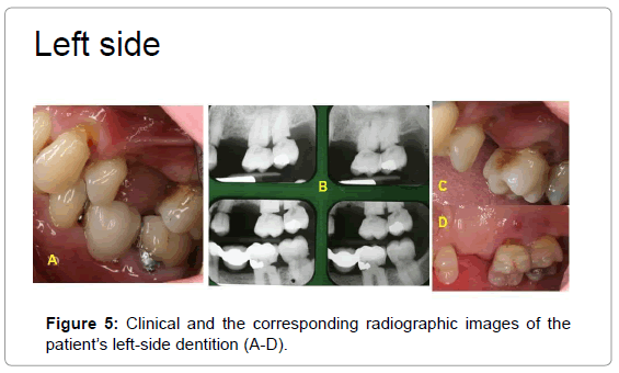 oral-hygiene-health-clinical-corresponding-left