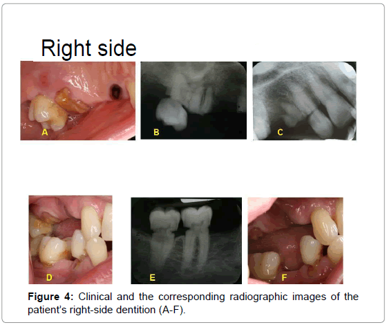 oral-hygiene-health-clinical-corresponding-right