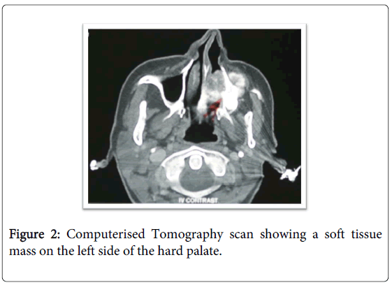 oral-hygiene-health-computerised-tomography