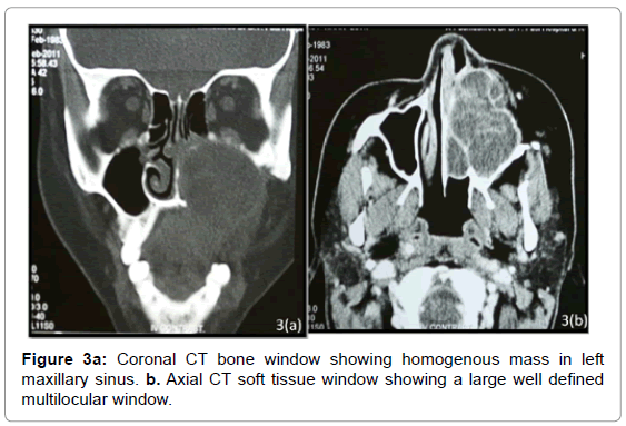 oral-hygiene-health-coronal-homogenous