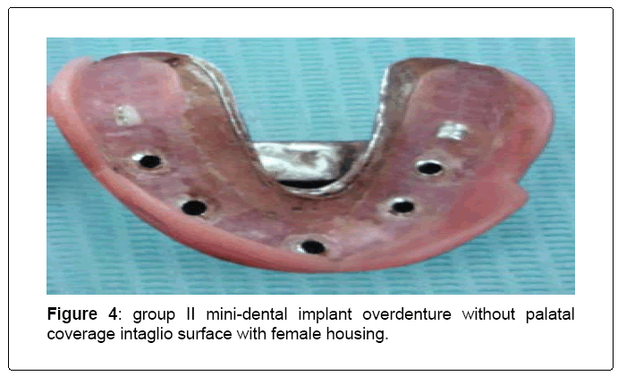 oral-hygiene-health-coverage