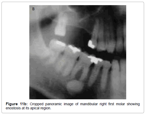 oral-hygiene-health-cropped-panoramic-image