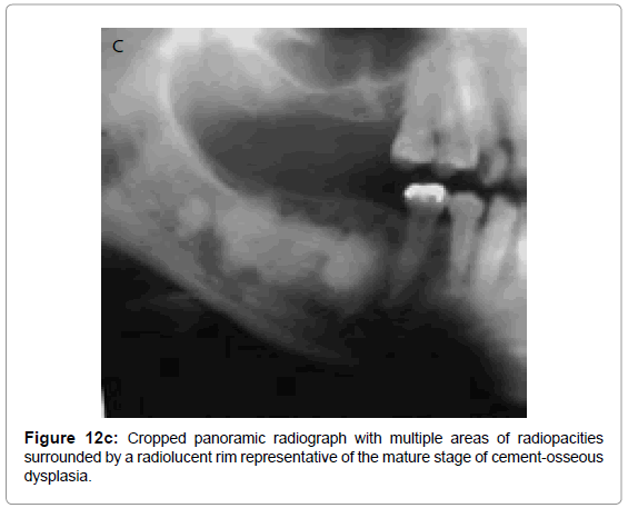 oral-hygiene-health-cropped-panoramic-radiograph