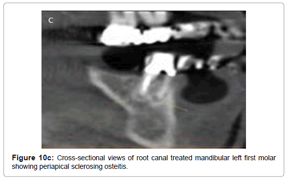oral-hygiene-health-cross-sectional-views-root