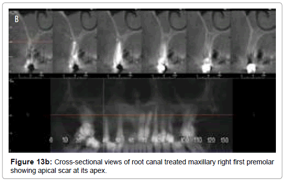 oral-hygiene-health-cross-sectional-views-root