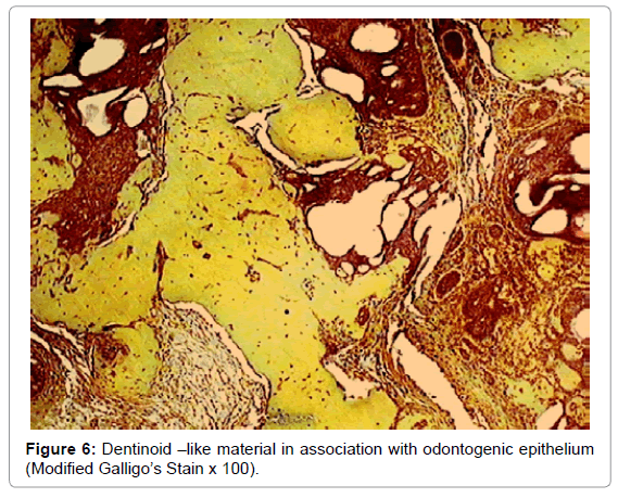 oral-hygiene-health-dentinoid-epithelium
