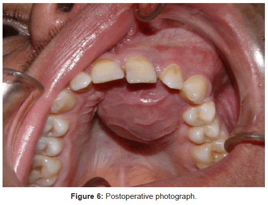 oral-hygiene-health-distribution-photograph