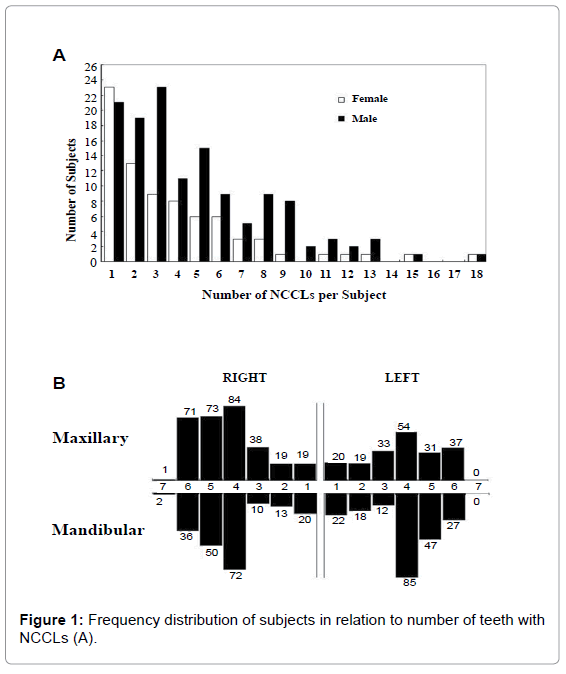 oral-hygiene-health-frequency-distribution