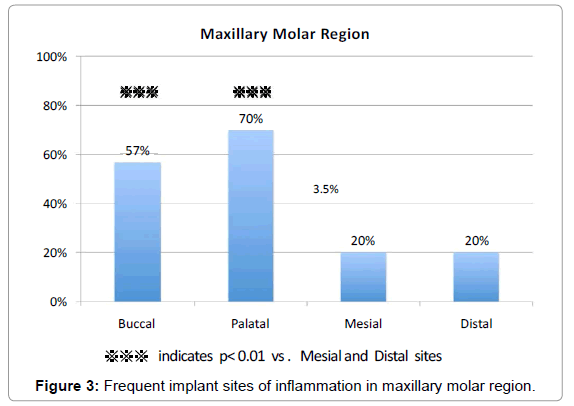 oral-hygiene-health-frequent-implant-maxillary