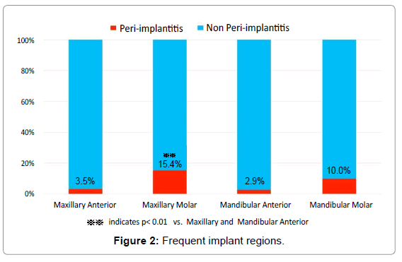 oral-hygiene-health-frequent-implant-regions