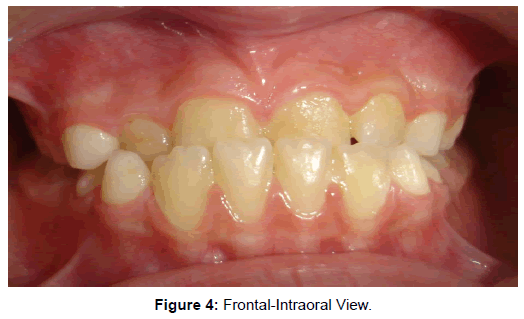 oral-hygiene-health-frontal-intraoral-View