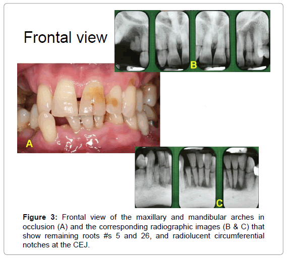 oral-hygiene-health-frontal-view-maxillary