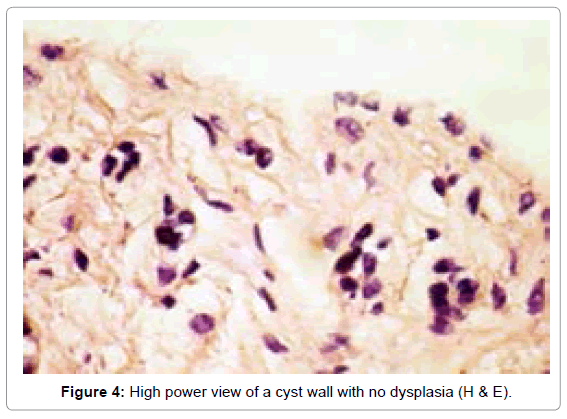 oral-hygiene-health-high-power-view-dysplasia