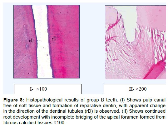 oral-hygiene-health-histopathological-pulp-canal