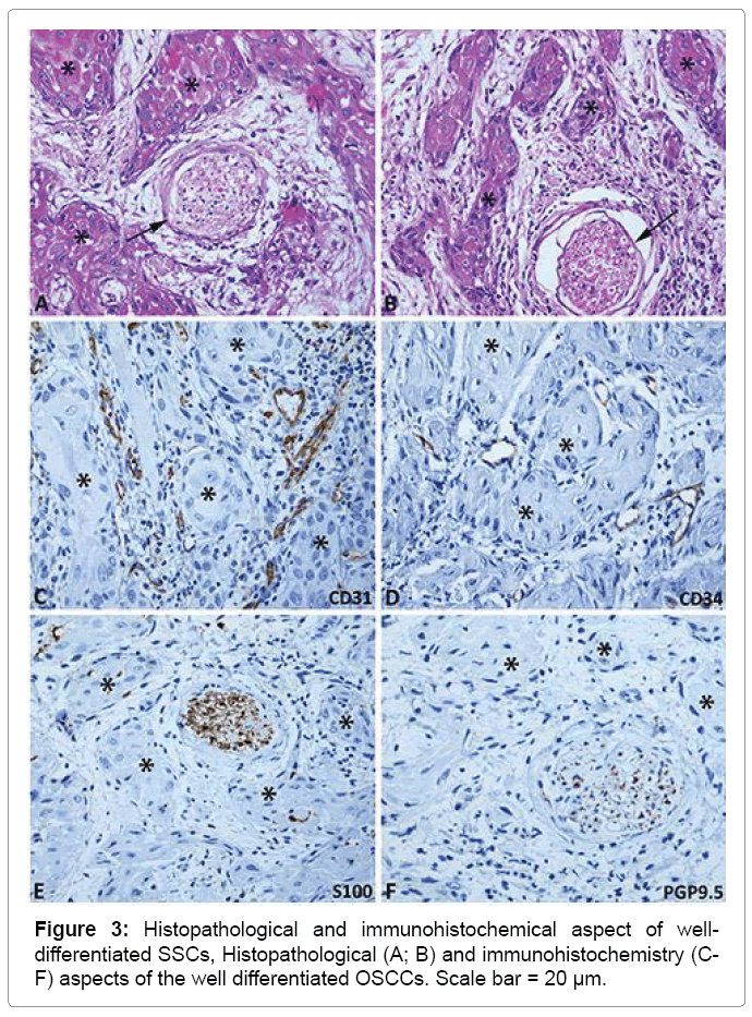 oral-hygiene-health-immunohistochemical
