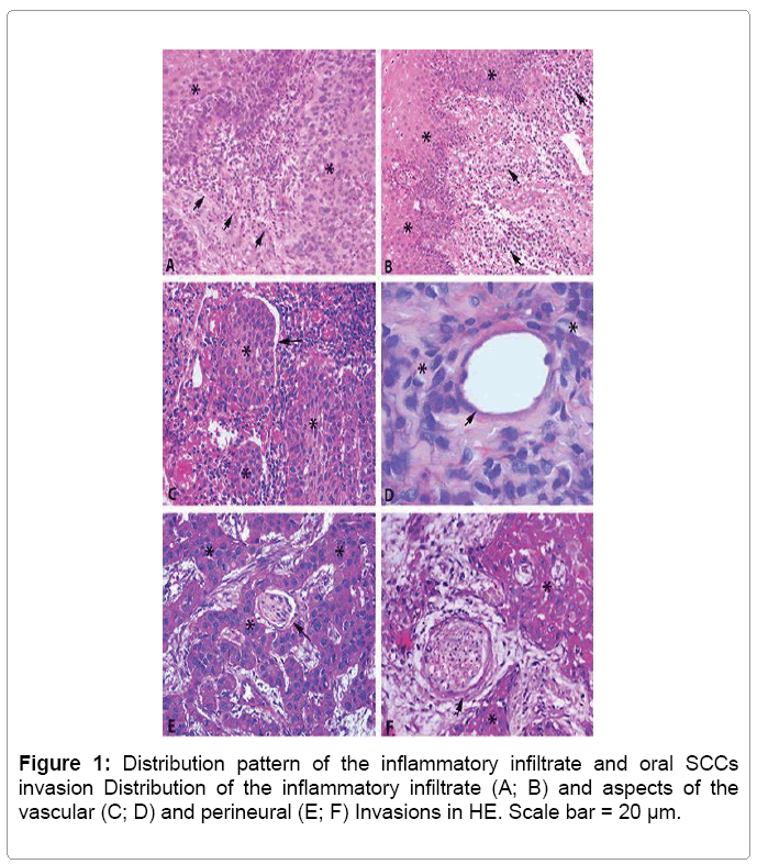 oral-hygiene-health-inflammatory
