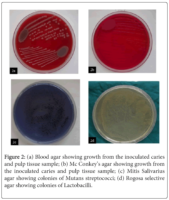oral-hygiene-health-inoculated