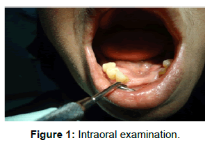 oral-hygiene-health-intraoral-examination