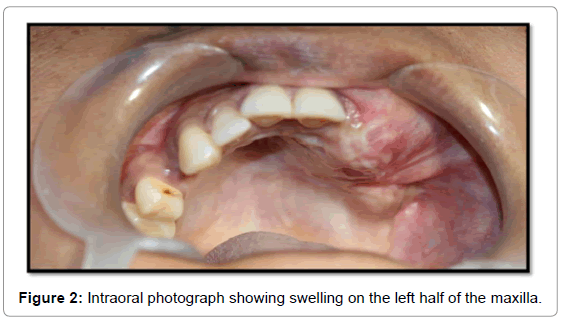 oral-hygiene-health-intraoral-photograph