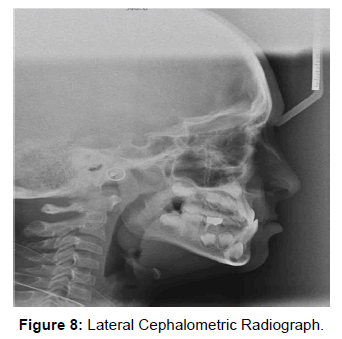 oral-hygiene-health-lateral-cephalometric