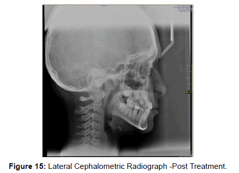 oral-hygiene-health-lateral-cephalometric