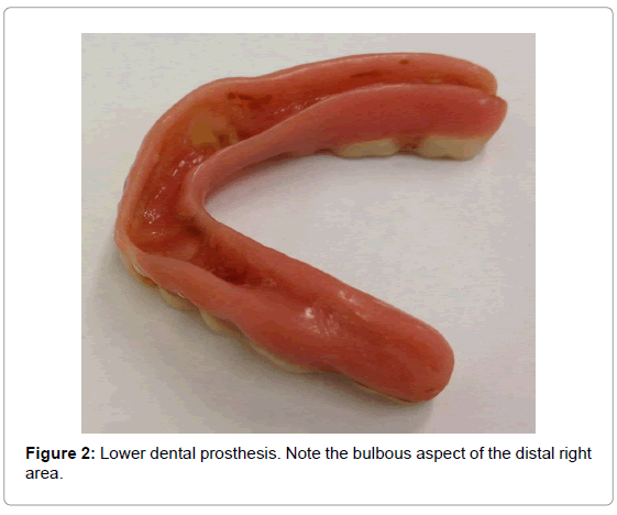 oral-hygiene-health-lower-dental-prosthesis