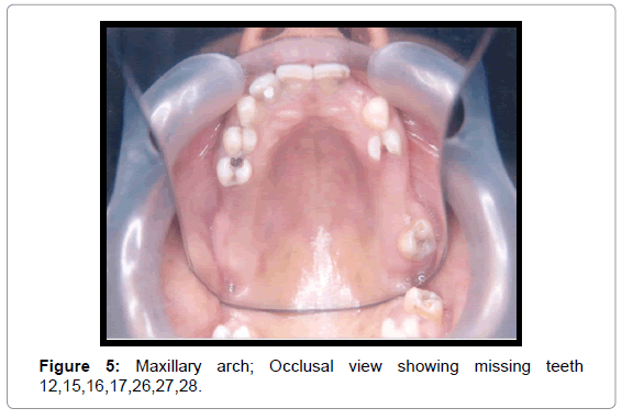 oral-hygiene-health-maxillary-arch-occlusal