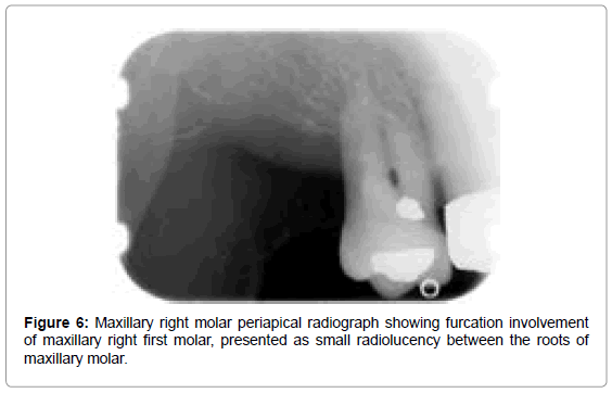 oral-hygiene-health-maxillary-presented-roots