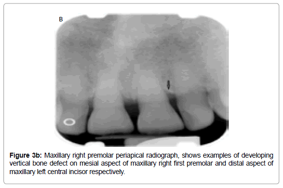 oral-hygiene-health-maxillary-right-examples