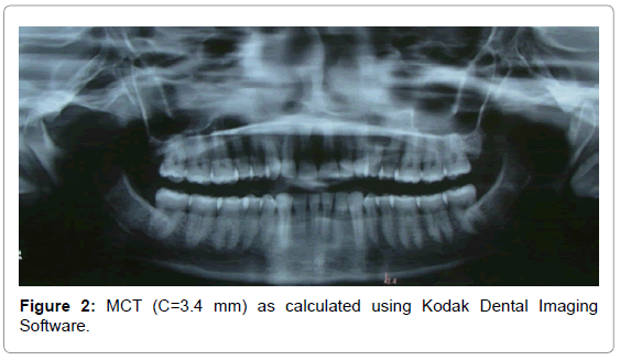 oral-hygiene-health-mct-calculated-software