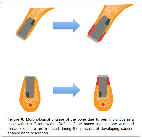 oral-hygiene-health-morphological-insufficient-width