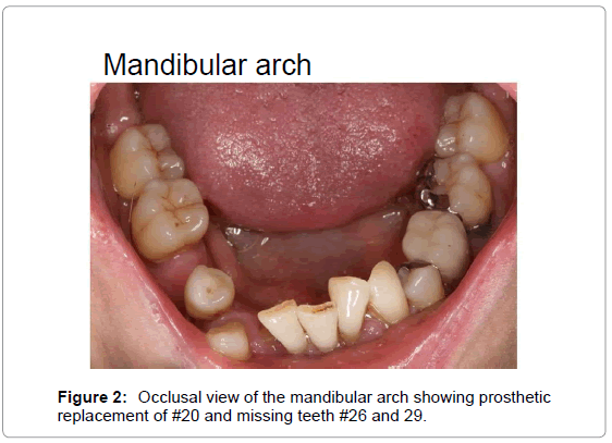 oral-hygiene-health-occlusal-view-mandibular