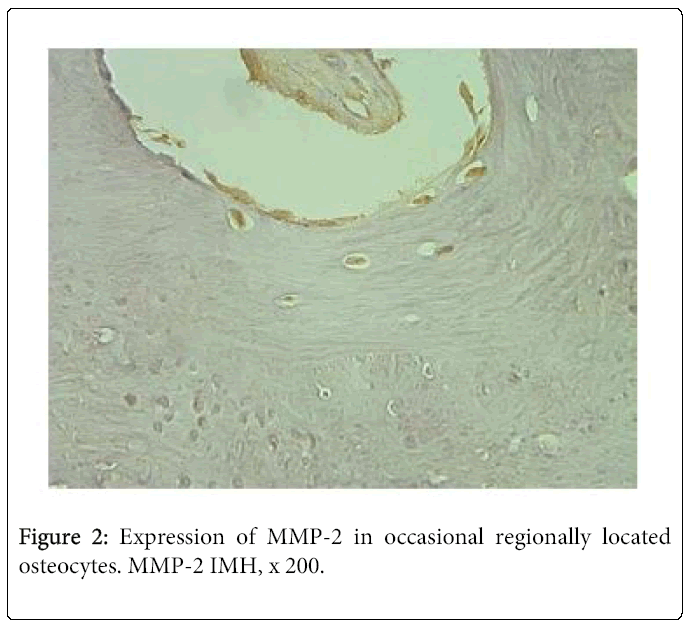 oral-hygiene-health-osteocytes
