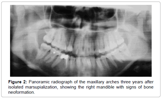 oral-hygiene-health-panoramic-isolated-mandible