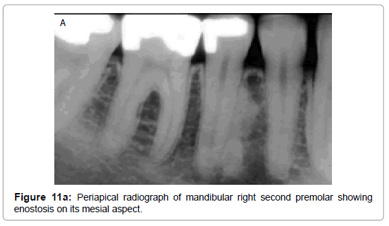 oral-hygiene-health-periapical-radiograph-mandibular