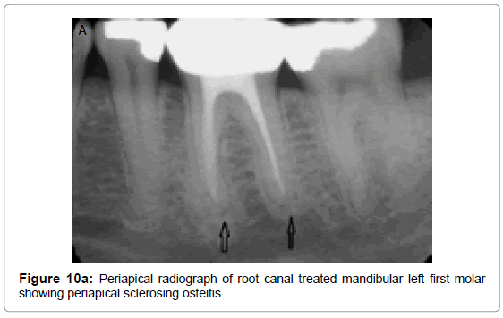 oral-hygiene-health-periapical-radiograph-root