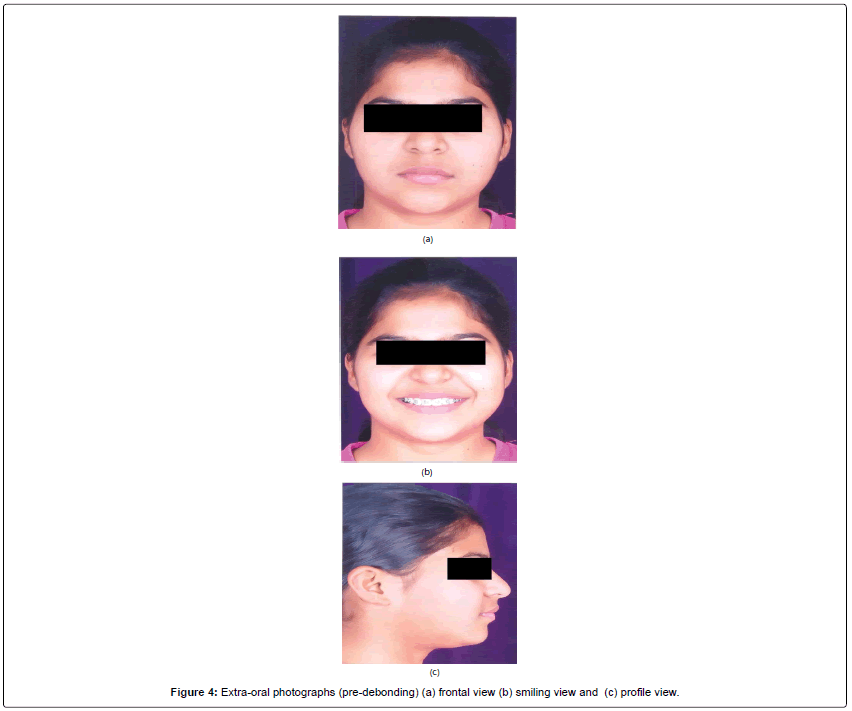 oral-hygiene-health-photographs-frontal-view