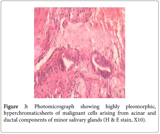 oral-hygiene-health-photomicrograph-pleomorphic