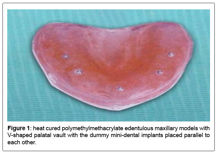 oral-hygiene-health-polymethylmethacrylate