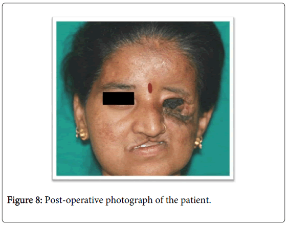 oral-hygiene-health-post-operative-patient