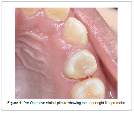 oral-hygiene-health-pre-operative-clinical