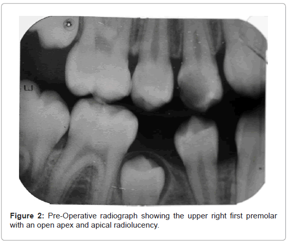 oral-hygiene-health-pre-operative-radiograph