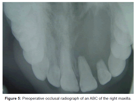 oral-hygiene-health-preoperative-occlusal