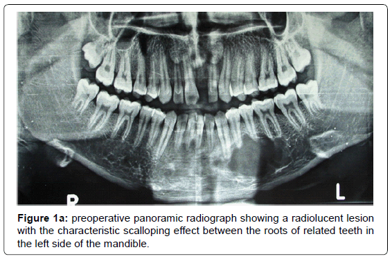 oral-hygiene-health-preoperative-panoramic